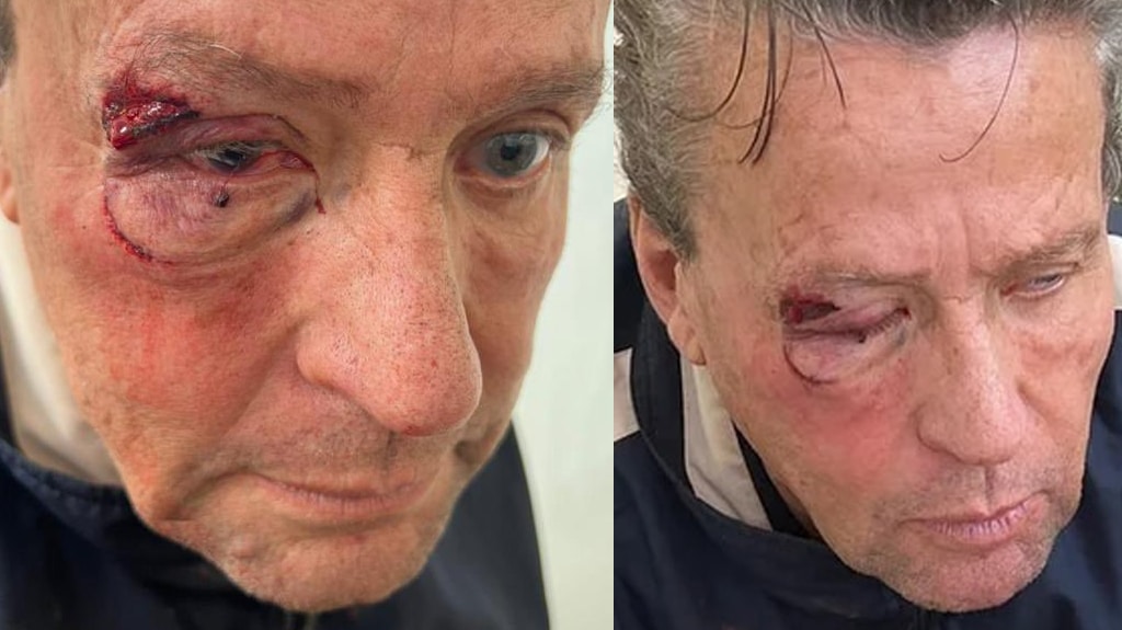 Le propinan brutal golpiza al actor Alfredo Adame