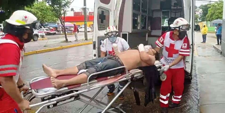 ¡Horror! Cortan las manos de un joven en Coatzacoalcos; lo acusan de ladrón