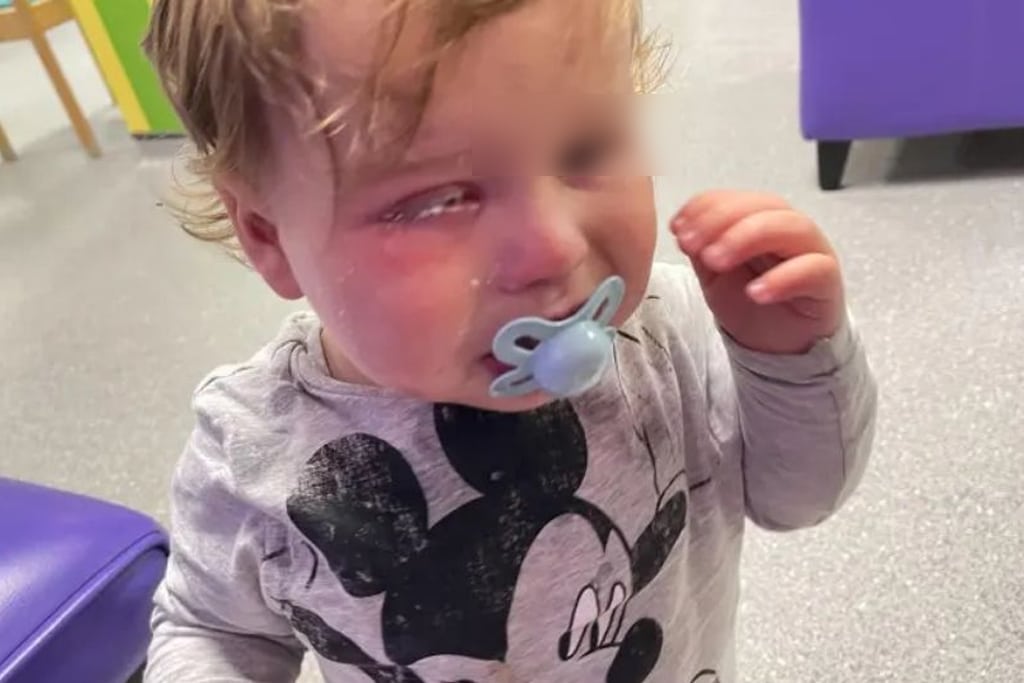 Maestra salpicó los ojos de un bebé con pegamento para uñas; ¡despedida!