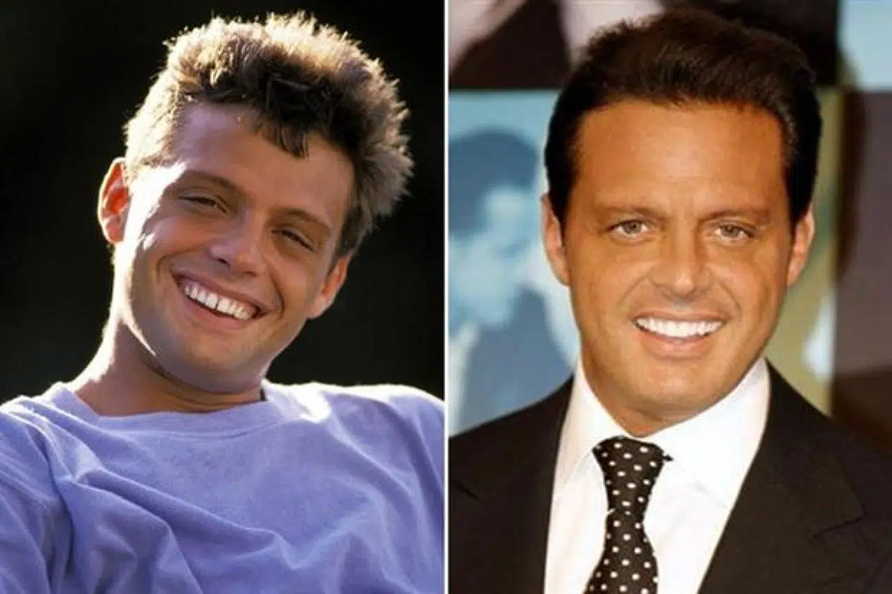 Por qué Luis Miguel tenía los dientes separados