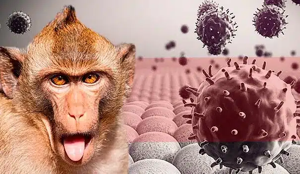 viruela del mono cambia a mpox