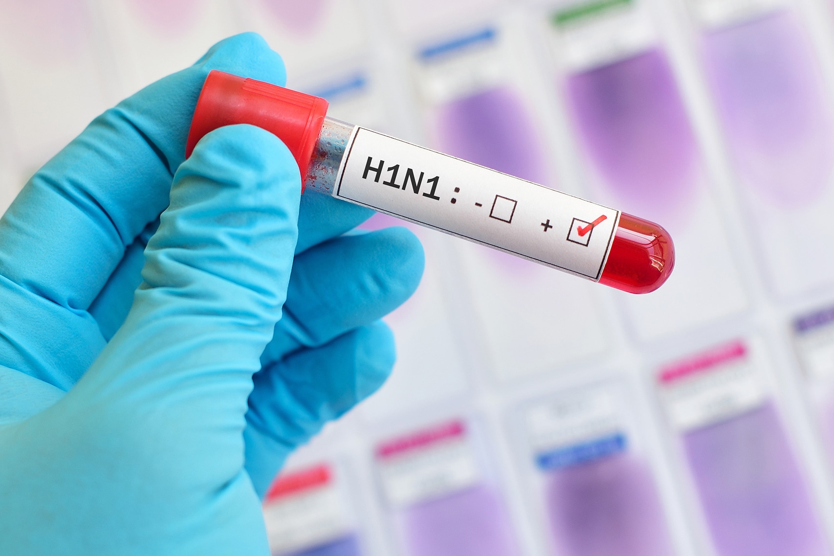 Influenza cobra tres vidas en Nuevo León; se trata de una mujer embarazada y dos menores de edad
