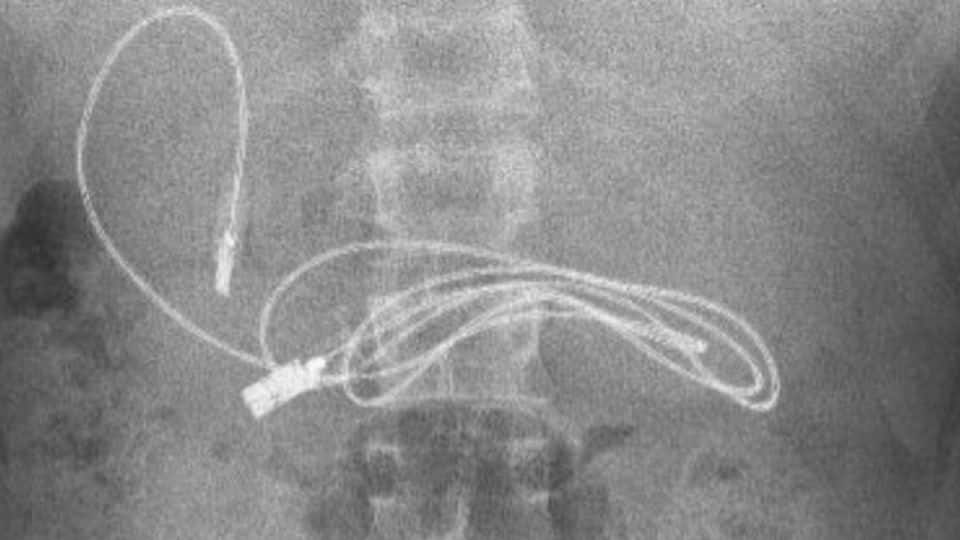 cable usb en el colon