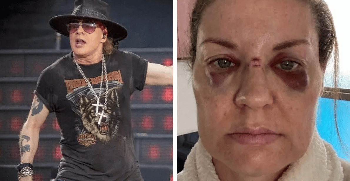 Axl Rose golpe a fanática