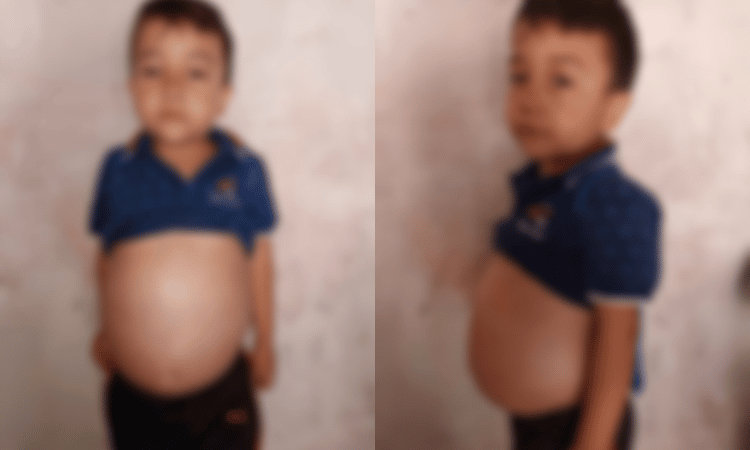 Niño enfermo en Tamazula