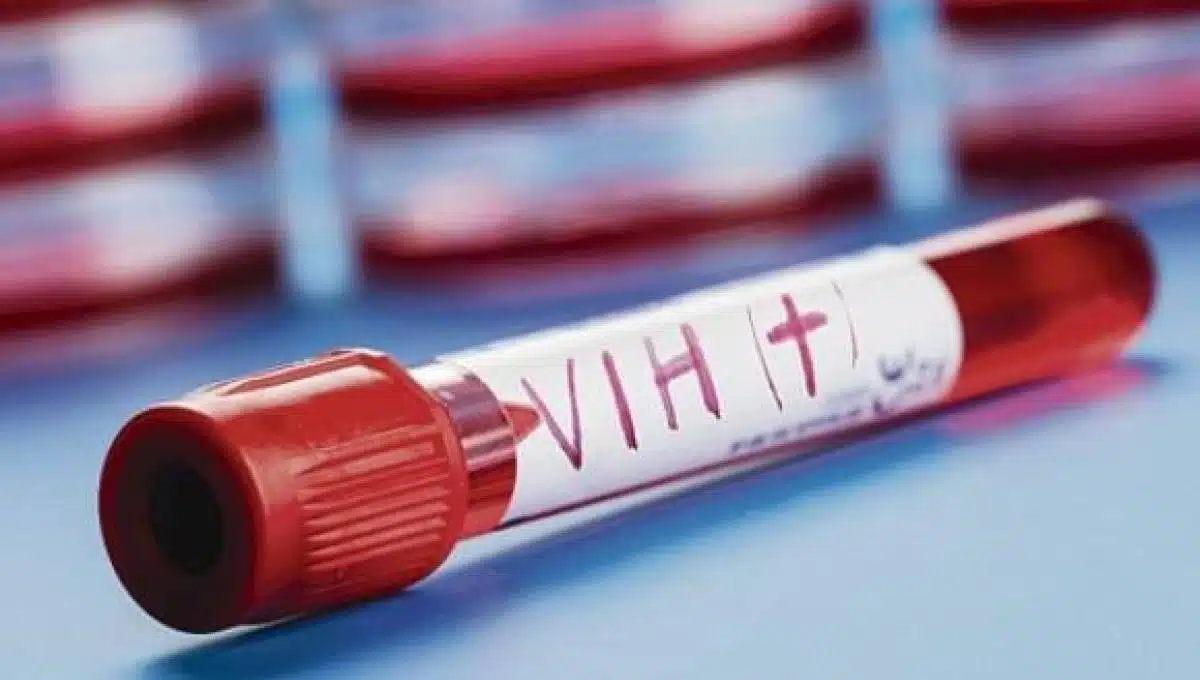 vacuna contra el VIH