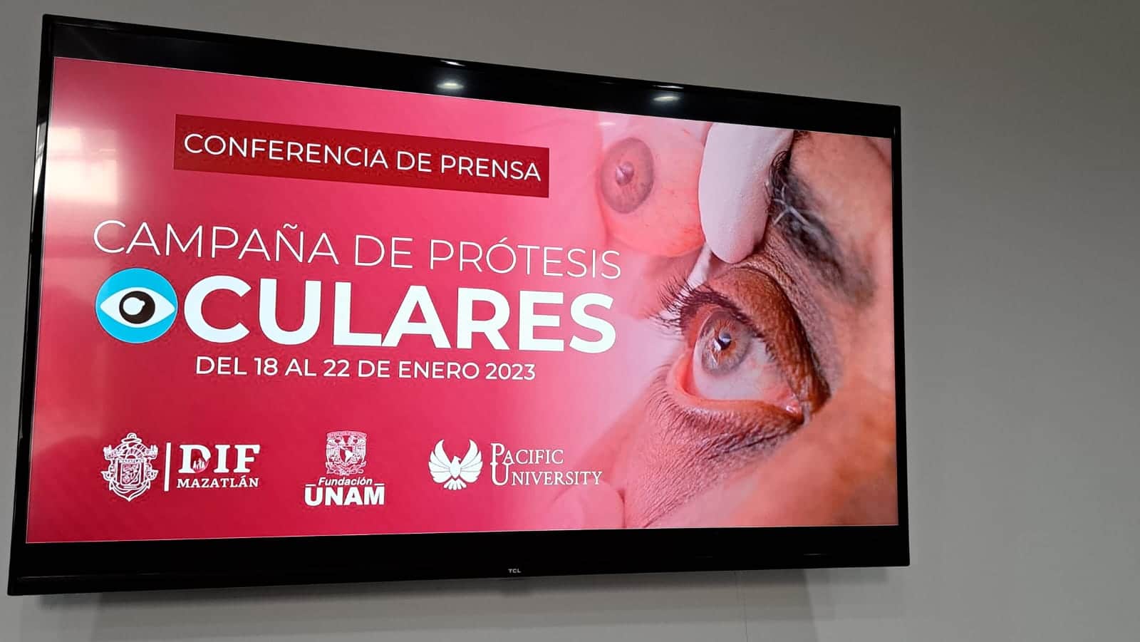 ¿Necesitas prótesis ocular