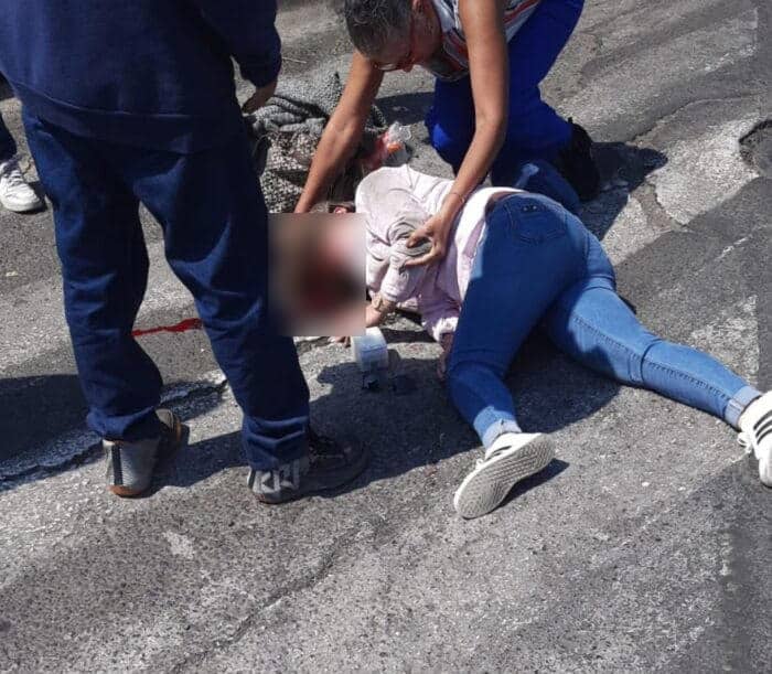 Mujer lesionada en CDMX