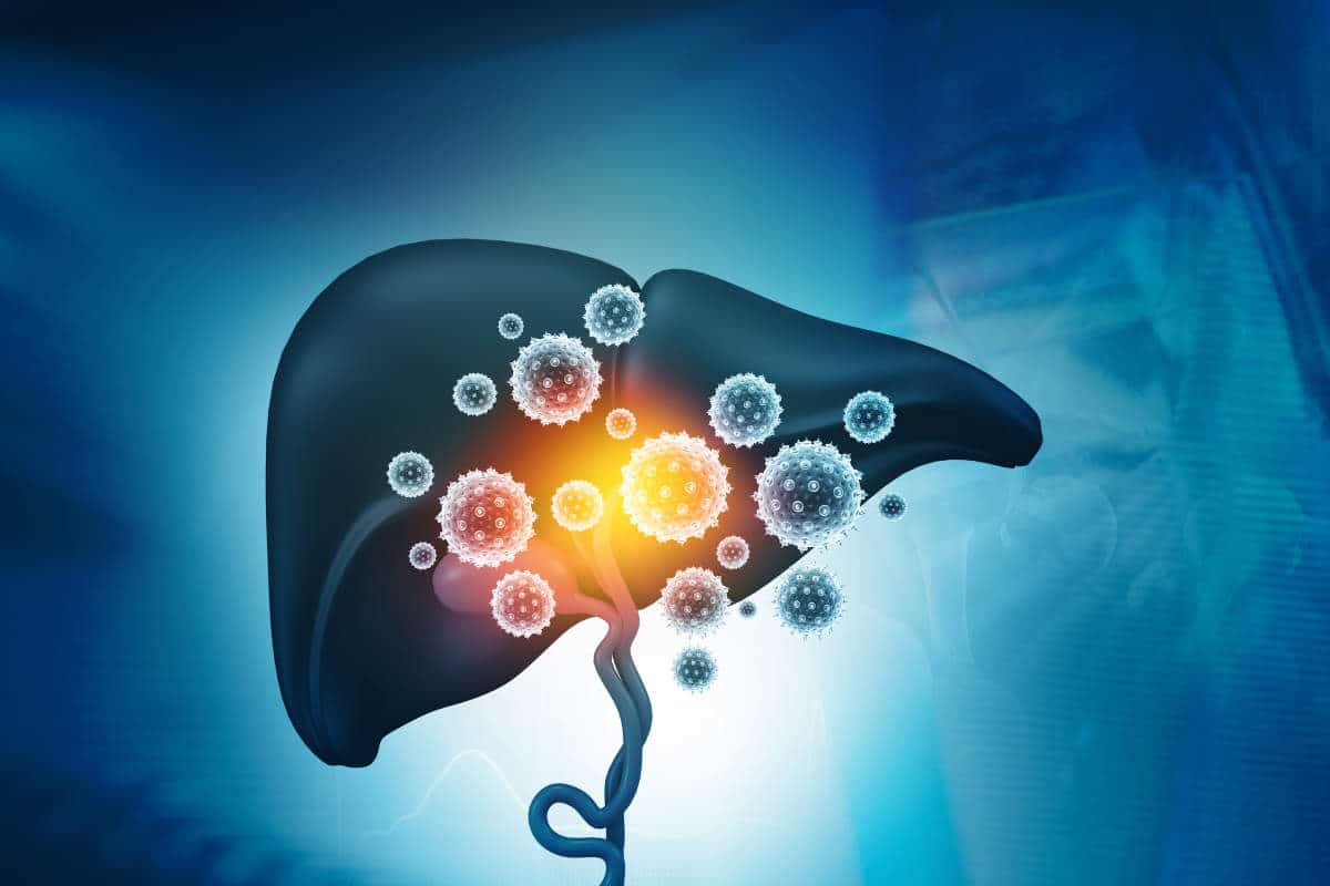 Hepatitis