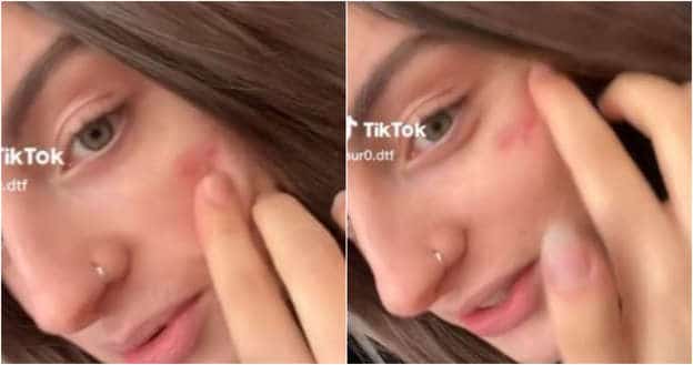 TikTok en la mira tras reto de cicatriz francesa, en Italia