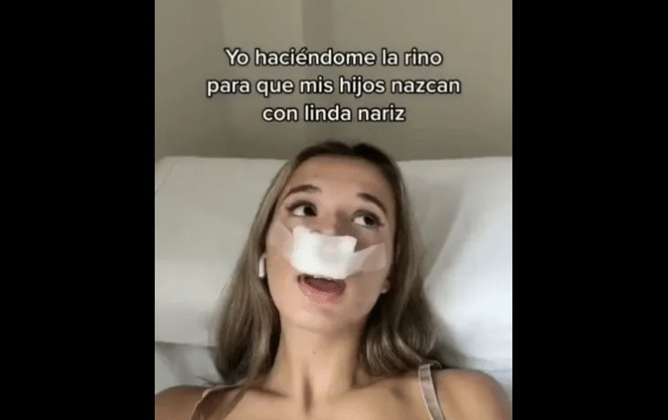Tiktoker rinoplastia