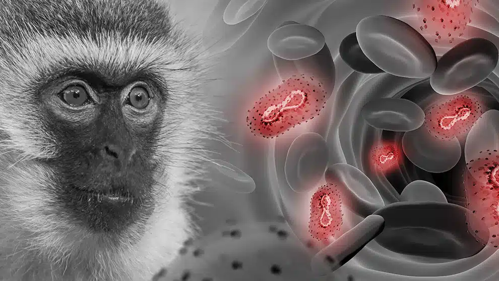 Detectan otros nueve casos de la viruela del mono en México; van 14 muertes