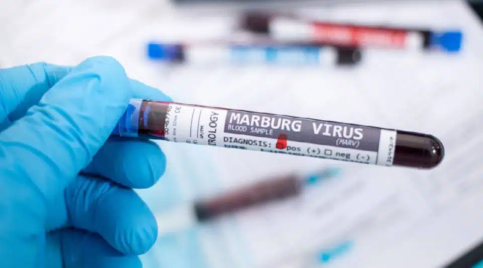 OMS recomienda vigilar brote del virus de Marburgo