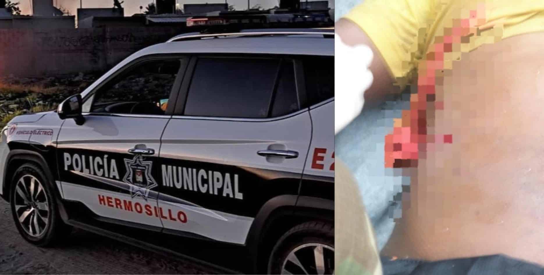 Tras ser agredida por su pareja, mujer se defiende con navaja de afeitar ¡Lo mandó a urgencias!