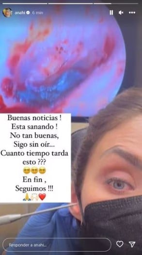 Anahí actualiza sobre el estado de su oído 
