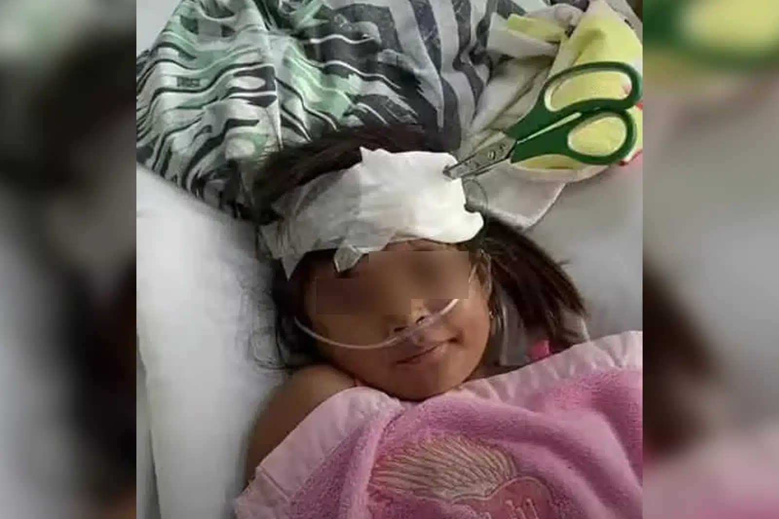 Niña duró una semana con tijeras en la cabeza porque sus padres no tenían para la operación