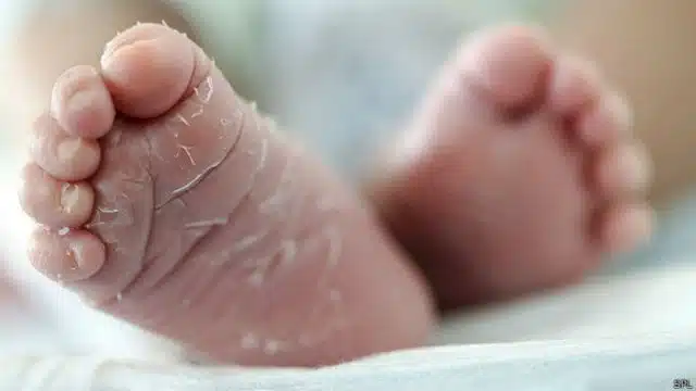 Reportan muerte de bebé a causa de una ameba “come cerebros”