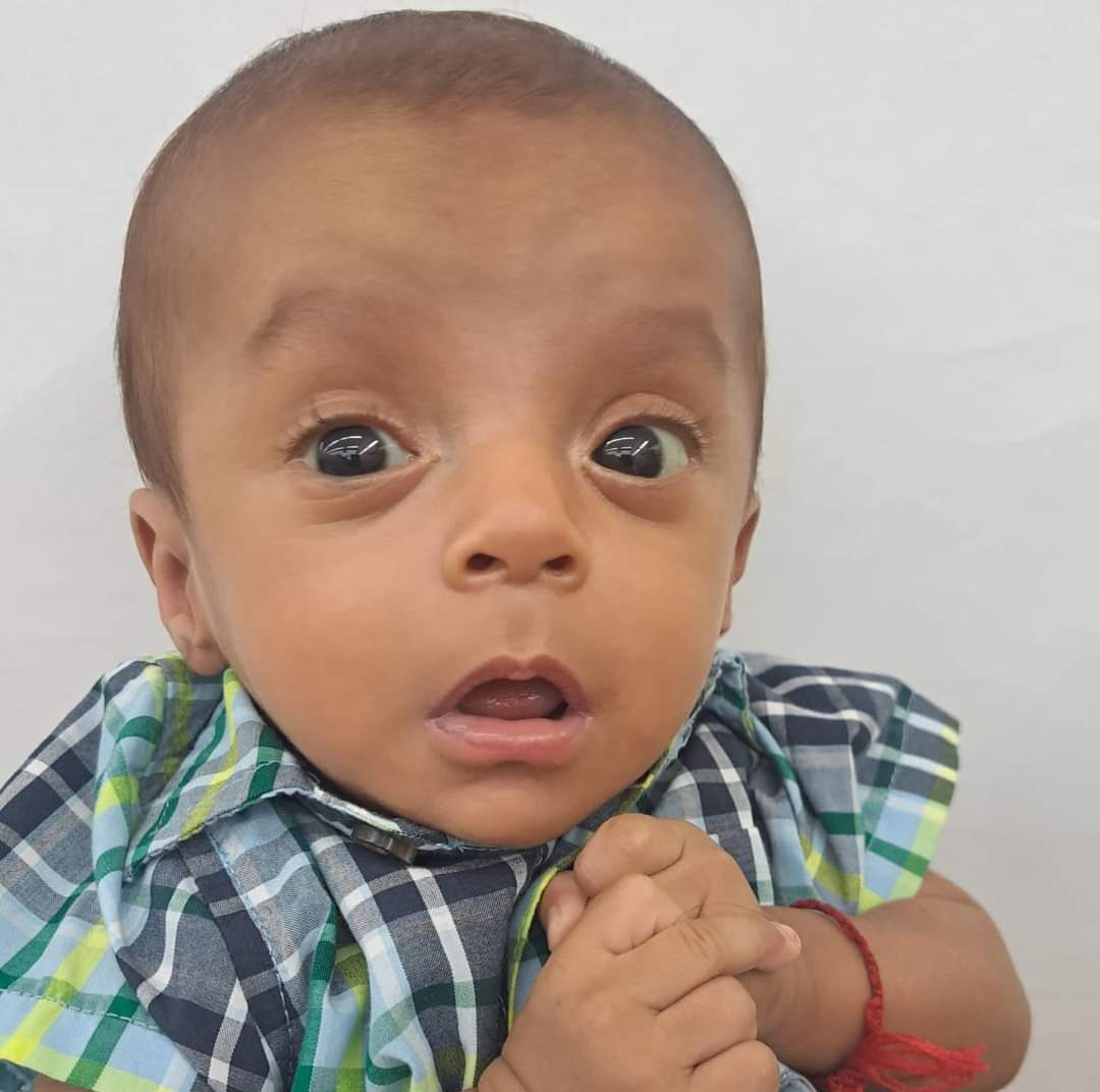 Ángel Tadeo nació a los 7 meses de gestación debido a un cuadro de preeclamsia