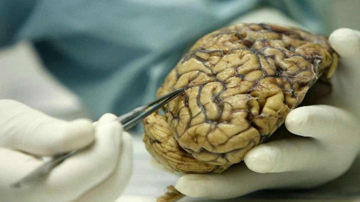 ¡Alerta en Canadá! Reportan rara enfermedad que deja a pacientes sin habla y con parálisis