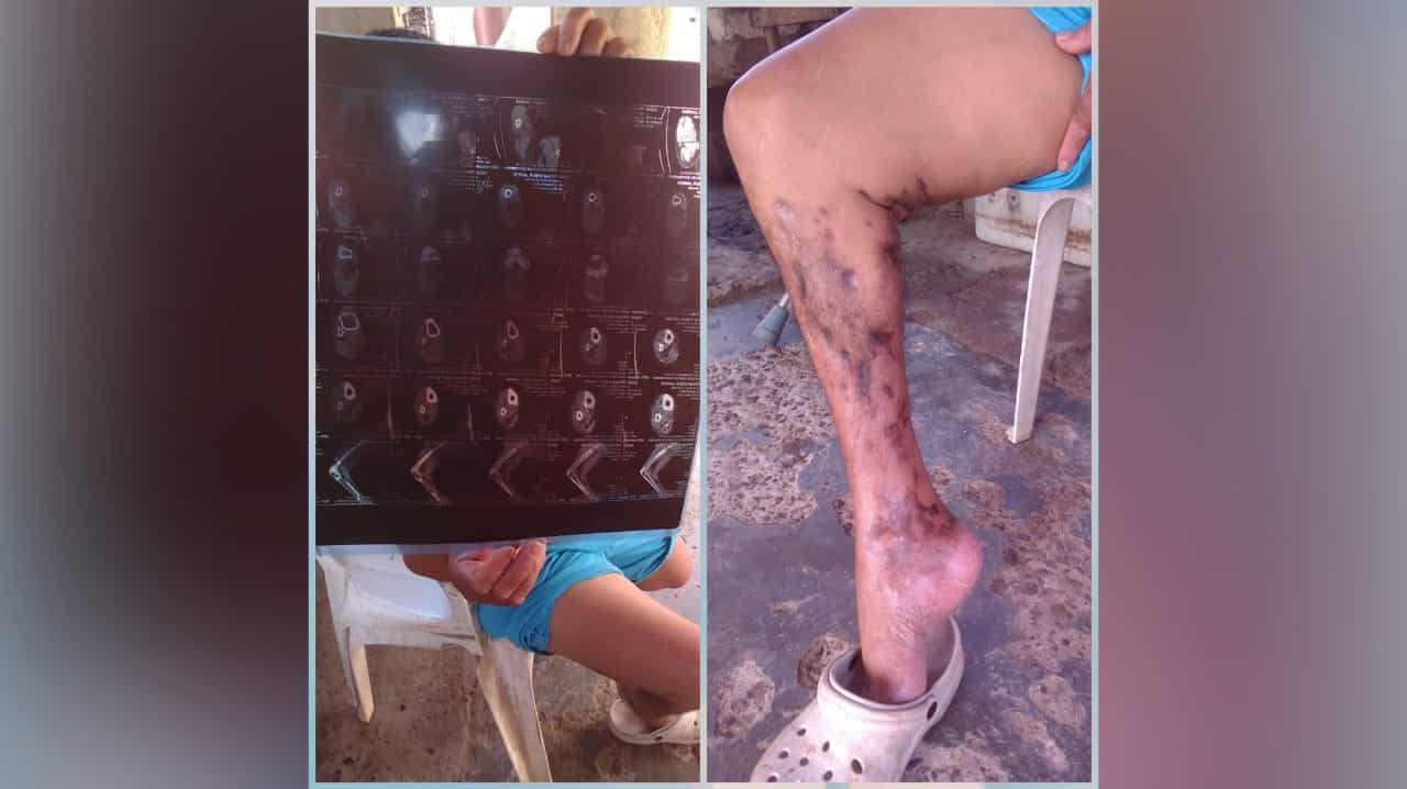Persona mayor pide ayuda para salvar su pierna.