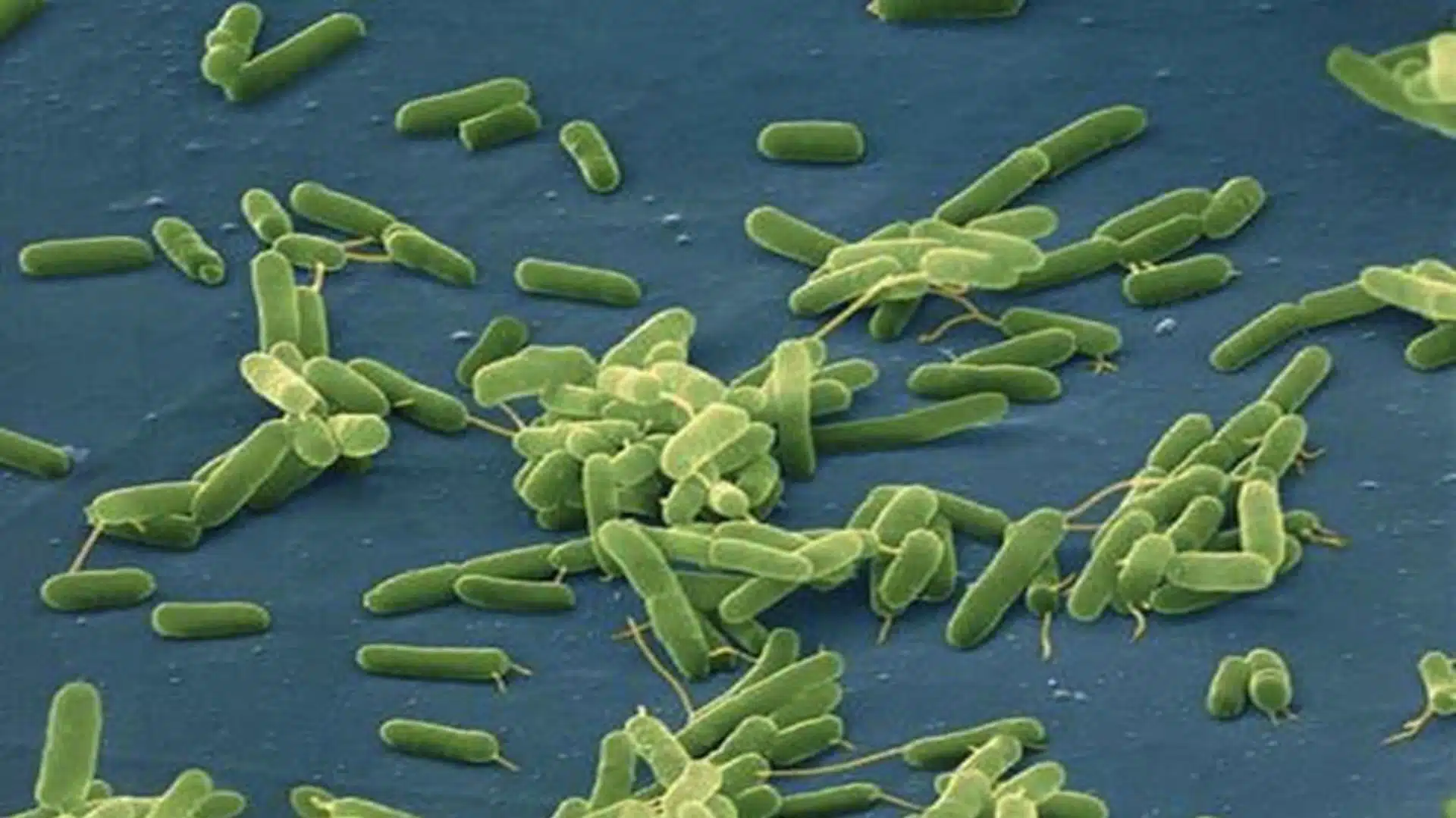 Infección bacteriana considerada como rara ha cobrado 3 vidas en Nueva York