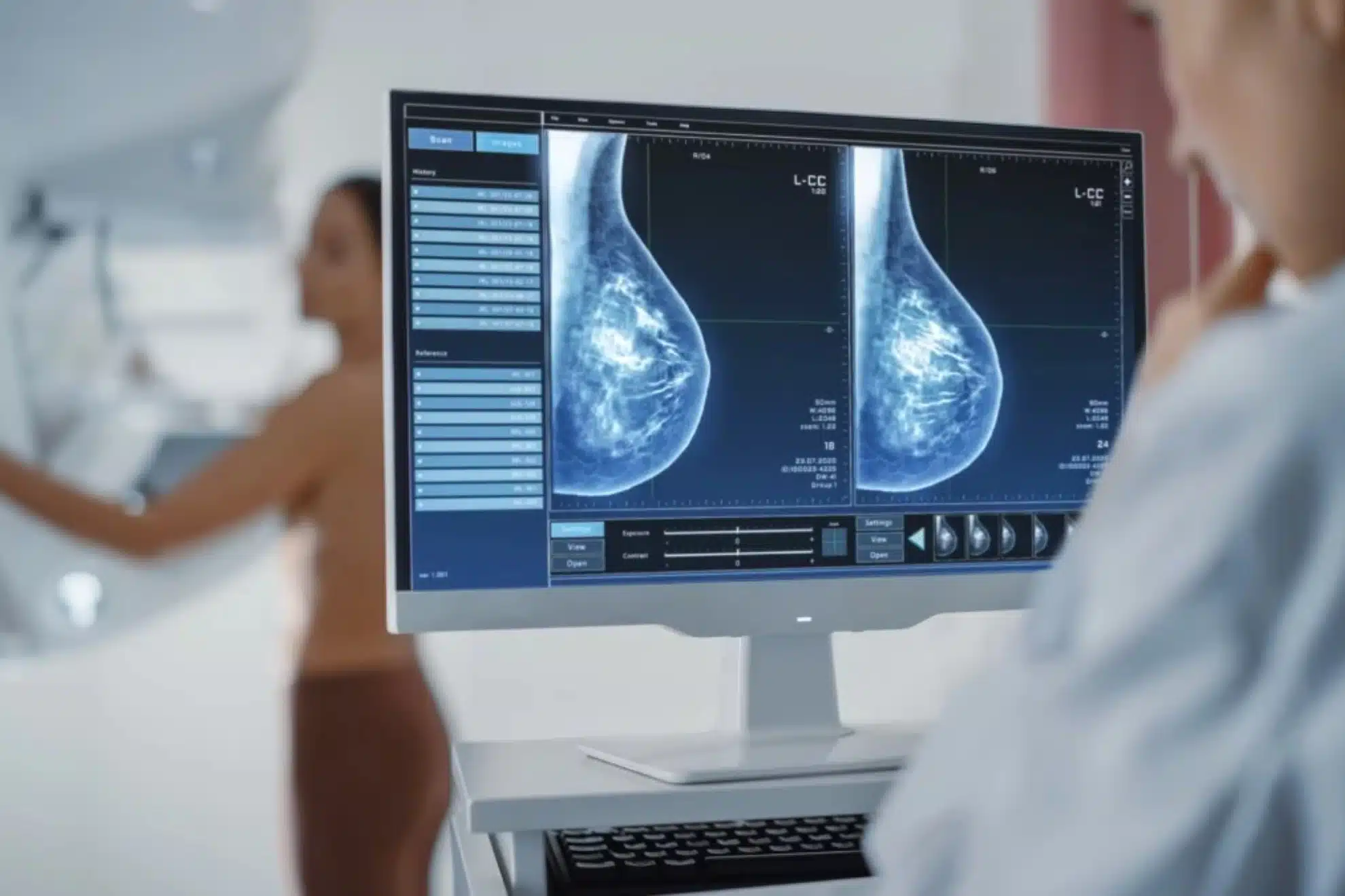 Inteligencia artificial ayudaría a una detección temprana del cáncer de mama