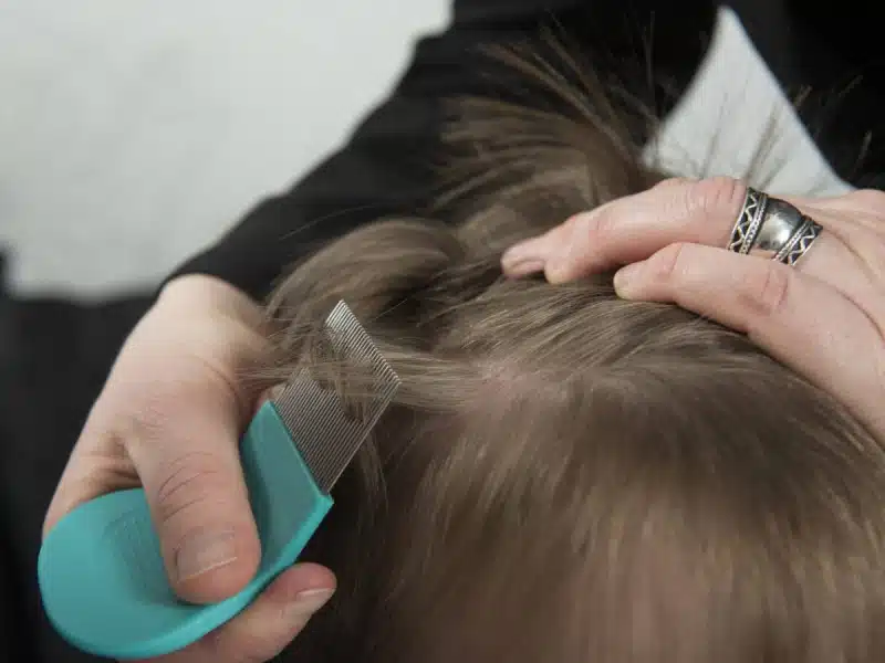 Mujer vegana se niega a deshacerse de los piojos de su hija