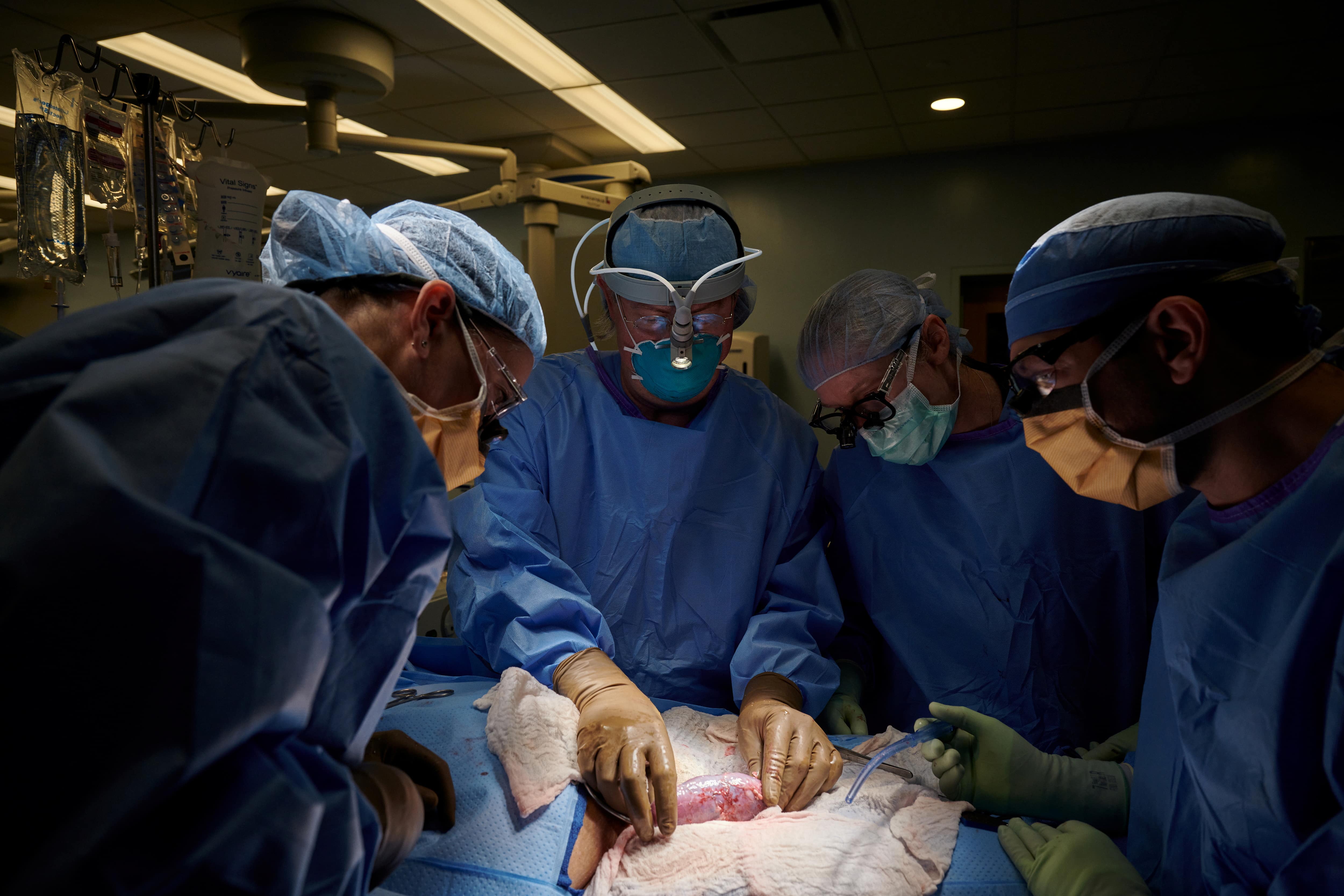 Logran que riñón de cerdo modificado funcione un mes en un cuerpo humano