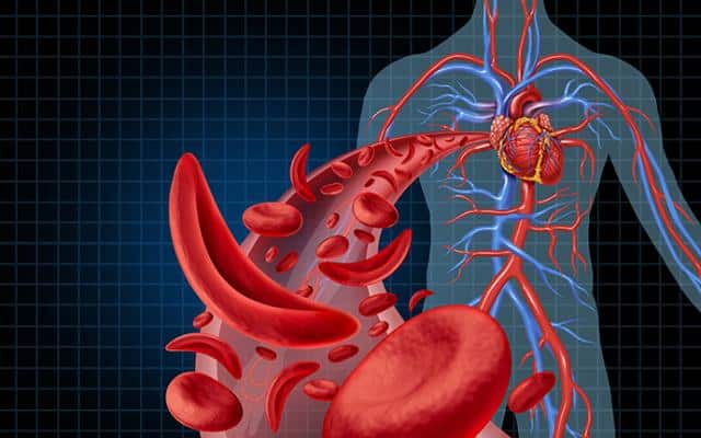 Si tienes anemia, aquí te traemos un listado de los alimentos que te ayudarán