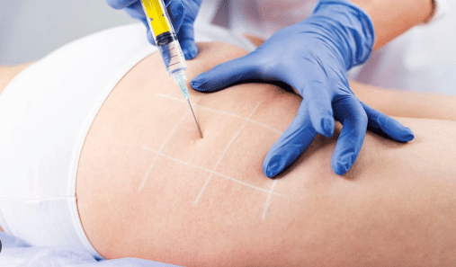 Doctor inyectando a mujer en el gluteo