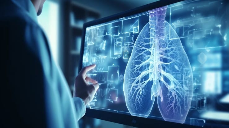 Inteligencia artificial permitiría detectar el cáncer de pulmón