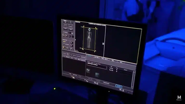 Rayos X realizados a supuestos extraterrestres