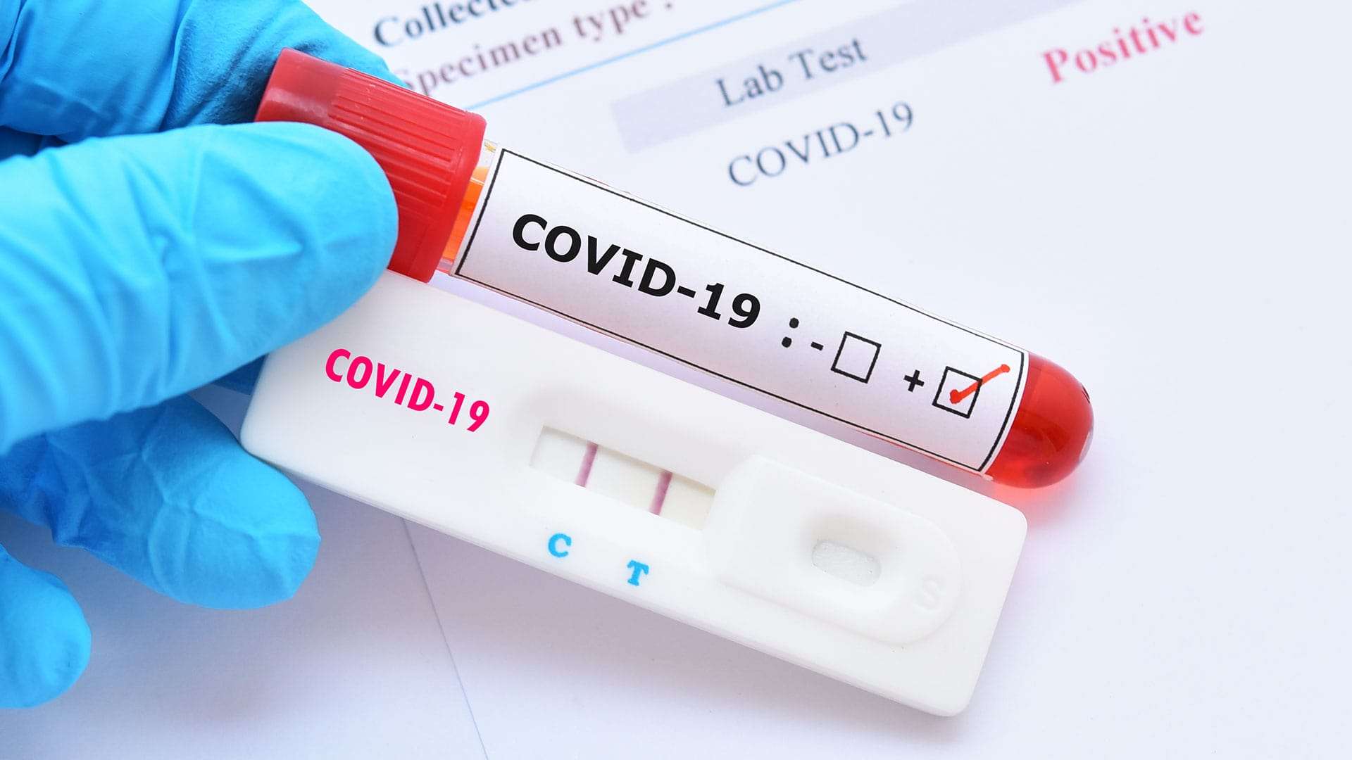 Prueba Covid-19