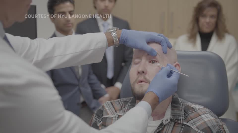 En Estados Unidos realizan el primer trasplante de ojo completo en el mundo