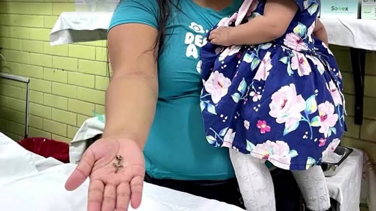 Menor de 10 meses de edad se traga un crucifijo