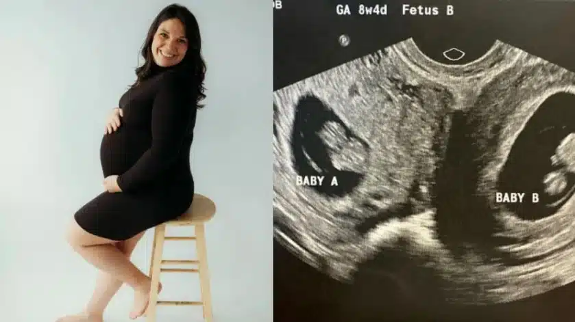 Mujer con doble útero resulta embarazada en ambos
