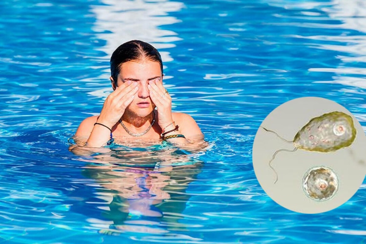 Niña colombiana muere a causa de una ameba come cerebros
