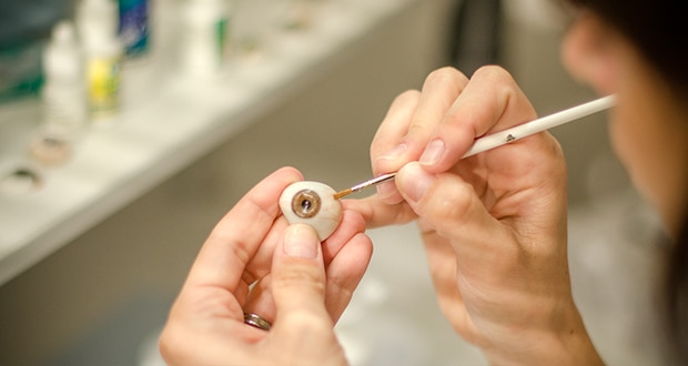 prótesis ocular