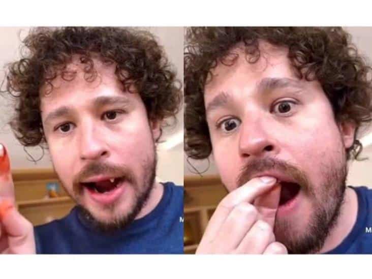 Luisito Comunica sin dientes