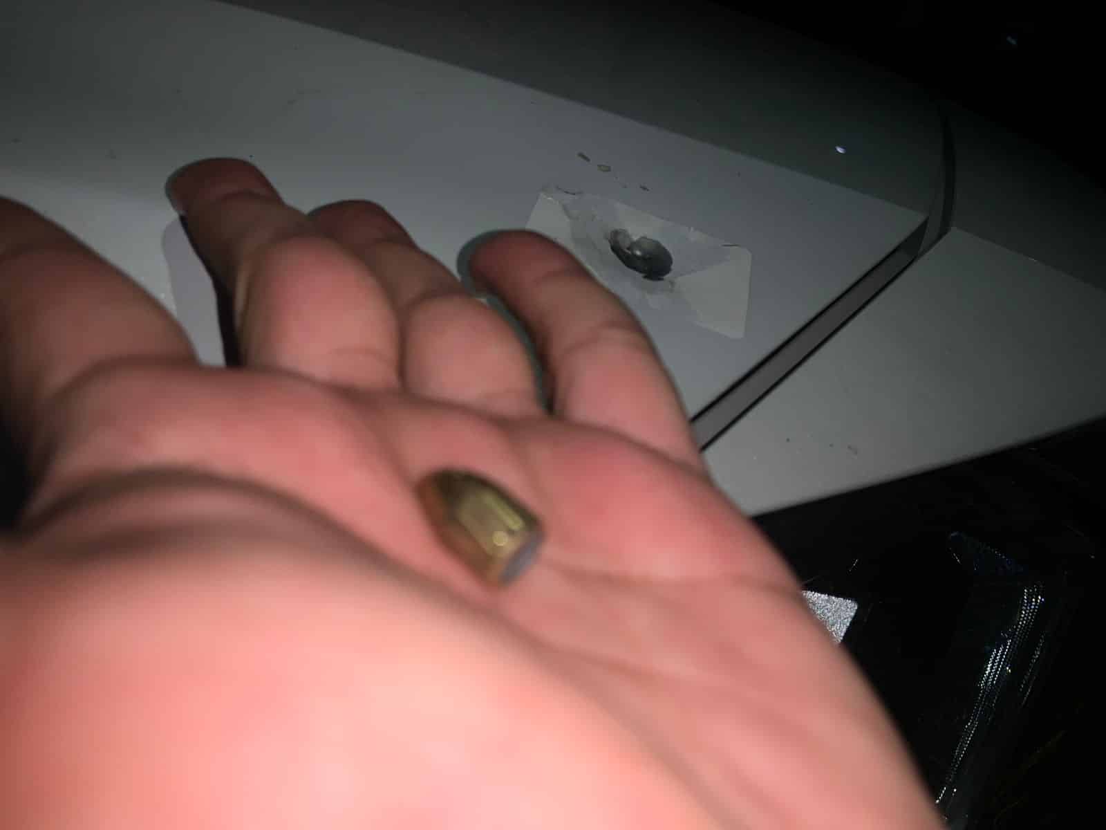 Bala en la mano de persona