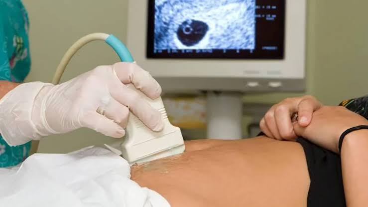 Francia busca inclusión del aborto en la Constitución