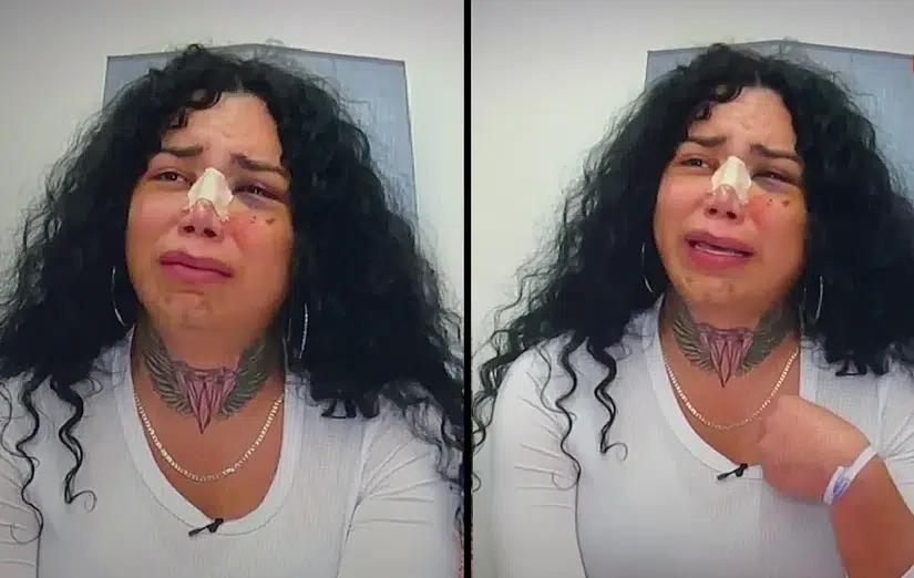 Paola Suárez revela que ya había sido golpeada anteriormente por su novio