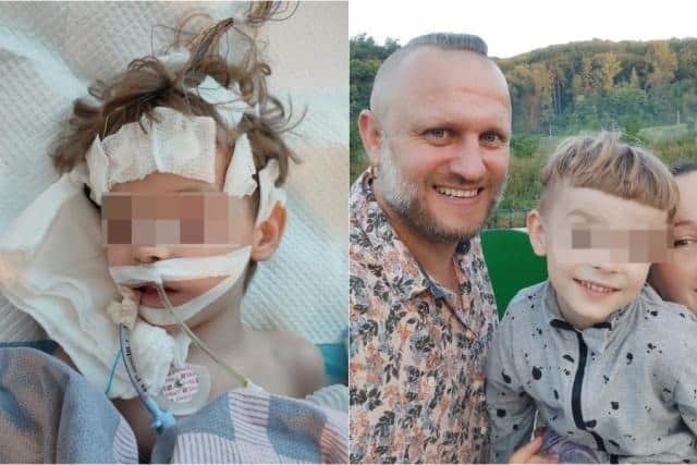 Niño conectado a aparatos médicos