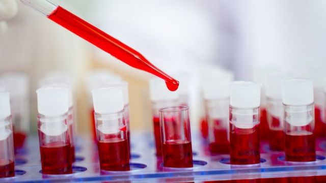Farmacéutica destina 4 mdd para apoyar lucha contra VIH en América Latina