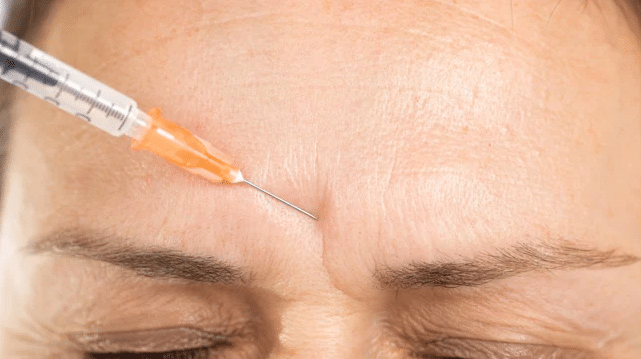 Aplicación de botox