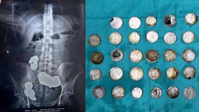 Joven fisicoculturista come monedas e imanes en India