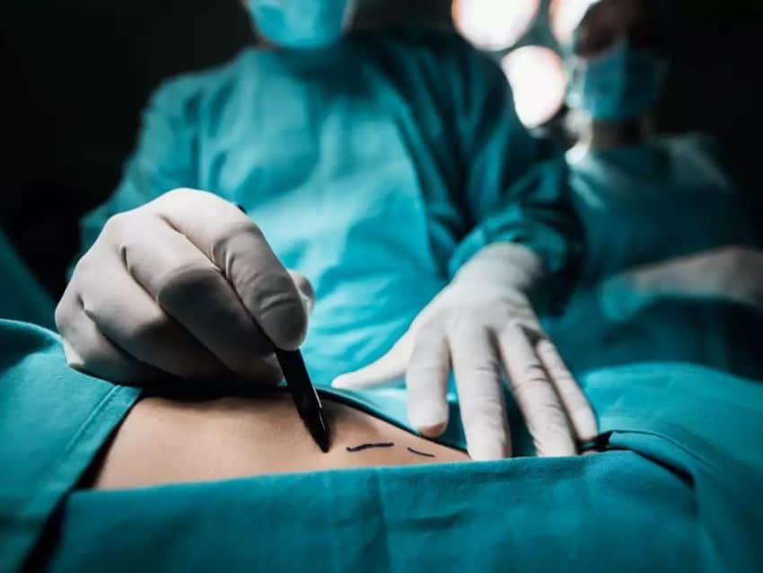 Le perforaron los órganos en cirugía para levantar glúteos; muere joven mujer...