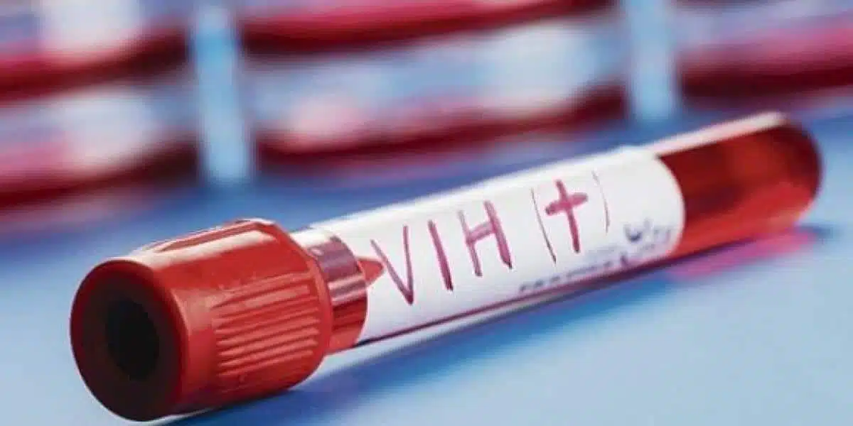 Científicos logran eliminar el VIH de las células infectadas