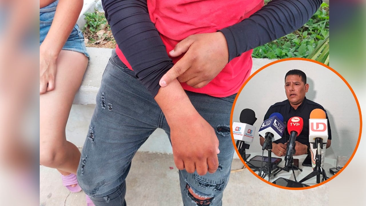 Los afectados compartieron a Línea Directa algunas fotografías en las que se pueden observar moretones o hematomas en la espalda, cuello y una lesión en el labio