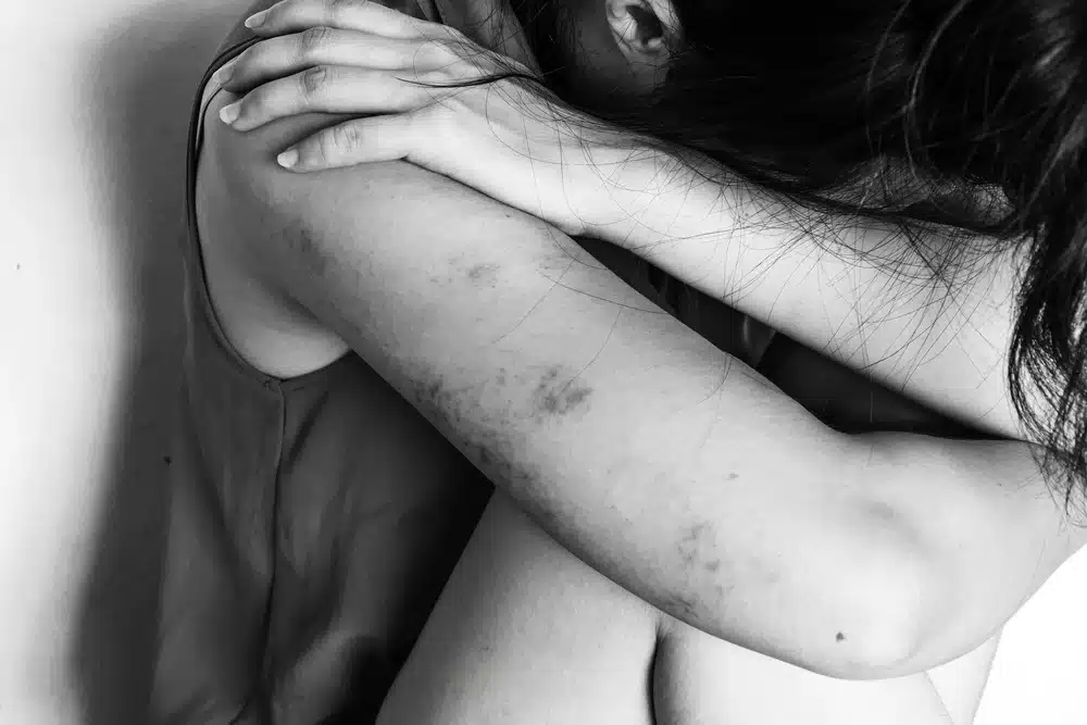 Casos de agresiones a mujeres en Los Mochis